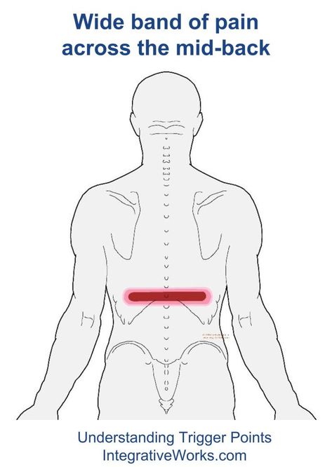 Trigger Points – Back Pain Across the Lower RibsIntegrative Works | Integrative Works Rib Pain, Mid Back Pain, Middle Back Pain, Low Back Stretches, Back Stretches For Pain, Frozen Shoulder, Back Pain Remedies, Sciatic Nerve Pain, Massage Benefits