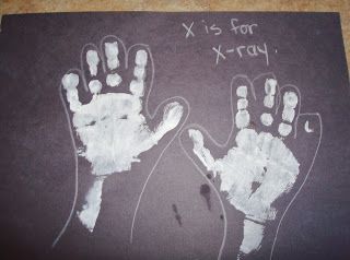 Reformed Ragamuffin: Kids: X is for X-ray (Doctor theme) Doctor Infant Crafts, Doctor And Nurses Activities Eyfs, Doctors And Nurses Preschool, Doctor Craft For Preschool, Qtip Crafts For Kids, Emergency Services Eyfs Activities, Emergency Services Activities For Kids, Doctor Crafts For Toddlers, Doctor Activities For Toddlers