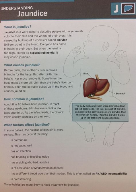 What is Jaundice? #jaundice #bilirubin #babyhealth Nicu Nurse Education, Newborn Nursing, Midwifery Student, Neonatal Care, Ob Nursing, Nursing Mnemonics, Surgical Nursing, Neonatal Nurse, Nursing School Notes