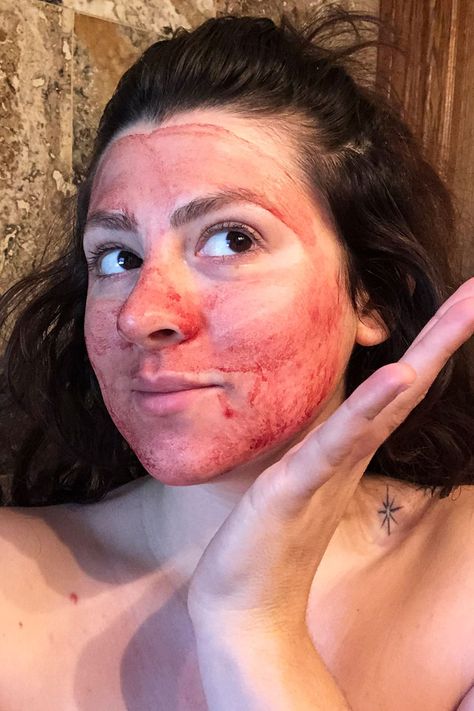 I Tried Menstrual Masking With My Period Blood and You Shouldn’t Period Aesthetic Blood, Period Magick, Blood Witch, Menstrual Blood, Blood Magick, Period Blood, Vampire Facial, Magick Spells, Skin Mask