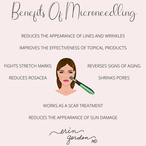 Learn about the benefits of #microneedling ! Microneedling Benefits, Benefits Of Microneedling, Client Card, 2024 Health, Rf Microneedling, Summer Skin Care Tips, Esthetician Inspiration, Medical Aesthetician, Esthetician Instagram