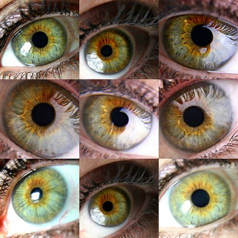 Central heterochromia is the uneven distribution of pigment in the eye, a genetic mutation. I've often wished I had Heterochromia iridum (eyes of two different colors) but, this is just as cool, I think. Those pictures are just about how my eyes look. Eye Color Facts, Central Heterochromia, Heterochromia Eyes, Rare Eye Colors, Hazel Green Eyes, Eye Color Chart, Rare Eyes, Different Colored Eyes, Green Eye