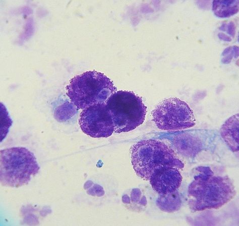 Cytology of a mast cell tumor from a Labrador Retriever. The magnification is 1000x. The cells are mast cells (although there are two granulocytes at the bottom and possibly a fibroblast to the right). The purple granules that are present in the cells are granules that contain histamine. Slide was stained with a modified Wright's stain. Basement Membrane, Meds For Dogs, Cats And Cucumbers, Allergic To Cats, Mast Cell, Electron Microscope, Veterinary Technician, Muscle Contraction, Nasal Congestion