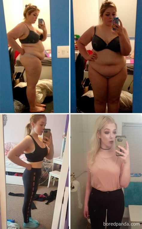 2 Years, 100 Lb Lost Tighten Stomach, Skin Firming Lotion, Saggy Neck, Tighten Loose Skin, Skin Bumps, Extra Skin, Saggy Skin, Fitness Challenge, Loose Skin