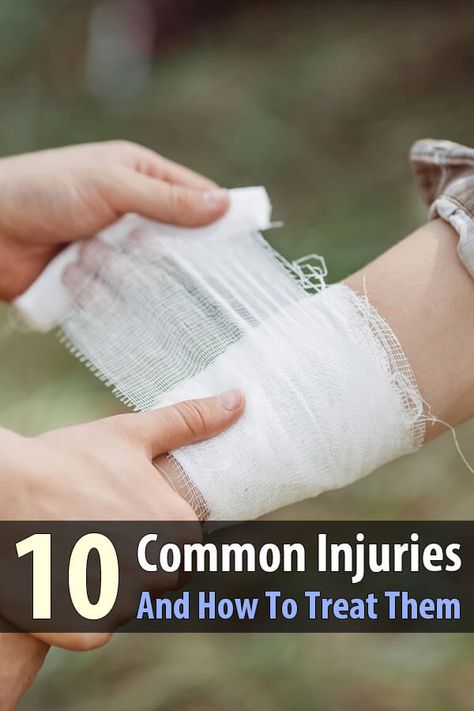 Basic first aid is not very complicated. And to prove it, I'm going to explain how to treat 10 common (and minor) injuries in one article. First Aid Hacks, First Aid Tips, Basic First Aid, Emergency First Aid, Elie Wiesel, Medical Kit, Emergency Medicine, Survival Life, Emergency Prepping