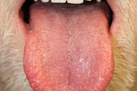 Bumps on the Tongue: What It Could Mean | Reader's Digest Bumps On Tongue, Squamous Cell, Liver Detoxification, Tongue Health, Wax Strips, The Tongue, Autoimmune Disorder, Cold Sore, Health Articles