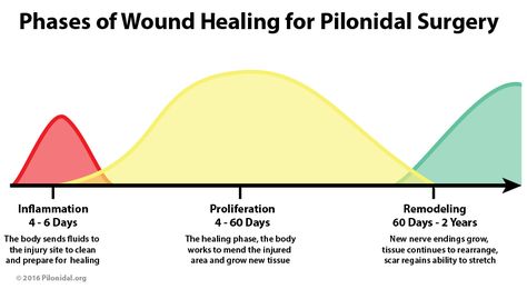 stages_of_wound_healing Wound Healing Stages, Medical Studies, Wound Care, Sports Medicine, Wound Healing, Htc One, Natural Body, Error 404, Master Class