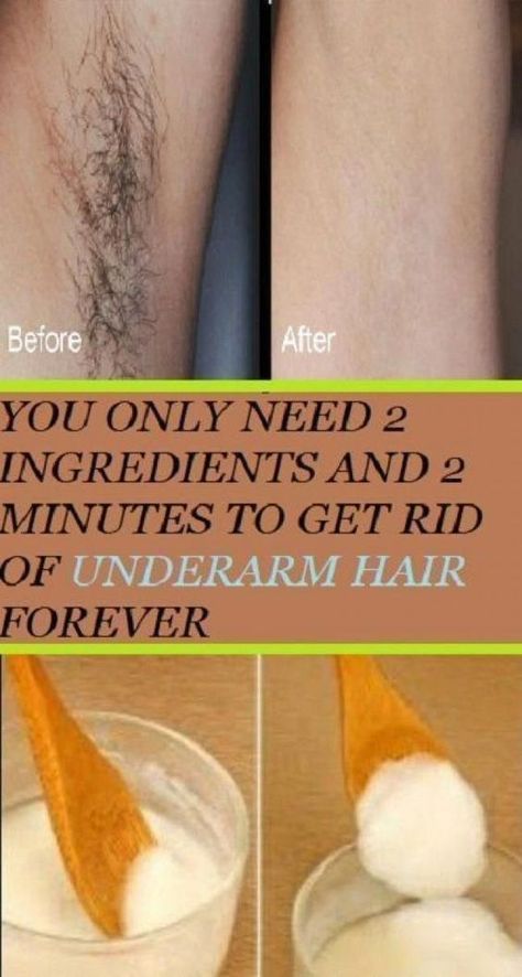 Best Permanent Hair Removal, Chin Hair Removal, Permanent Hair Removal Cream, Best Facial Hair Removal, Leg Hair Removal, Lip Hair Removal, Chin Hair, Unwanted Hair Permanently, Unwanted Hair Growth