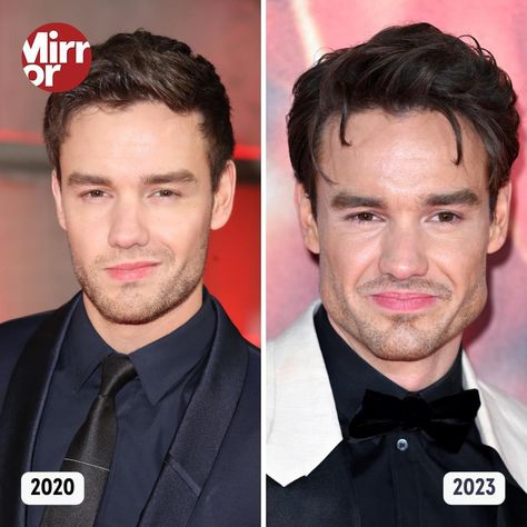 Liam Payne, Body Language, Plastic Surgery, Mother Of The Bride Dresses, Face And Body, Mother Of The Bride, Diy Gifts, Surgery, Gifts