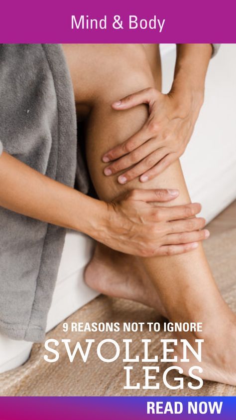 WellTuned shares 9 reasons why swollen legs should never be ignored Heavy Legs Remedies, God Prayer Quotes, Shortness Of Breath Remedies, Medical Remedies, Last Week Of Pregnancy, Ways To Be Happy, Calf Cramps, Running Techniques, Venous Insufficiency