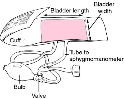 Sphygmomanometer | definition of sphygmomanometer by Medical dictionary Bp Apparatus Aneroid Sphygmomanometer, Sphygmomanometer Parts, Anesthesia School, Parts Of Blood, Ma Notes, What Is Blood, Medical Terminology Study, Nurse Study, What Is Blood Pressure