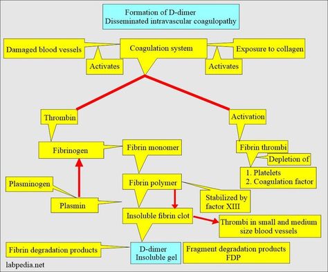 D-Dimer test What Sample for the D-Dimer test is needed? Citrated plasma is needed. It is stable for 8 hours at room temp. It can be kept at -20 °C for 6 months. Indications for D-Dimer test This test is done to diagnose DIC (disseminated intravascular coagulopathy). It can diagnose other thromboembolic disorders (venous thrombosis). It can diagnose Pulmonary embolism. For the diagnosis of acute myocardial infarction. D-dimer may be increased by atrial fibrill... Coagulation Cascade, D Dimer, Clinical Laboratory, Subarachnoid Hemorrhage, Hypersensitivity Reactions, Body Human, Medicine Notes, Liver Failure, Atrial Fibrillation