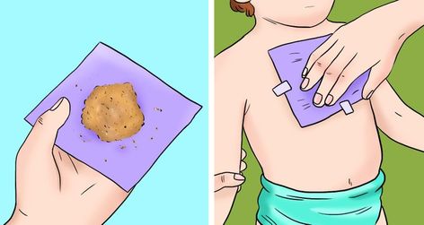 6 Signs Your Body Is Producing Excessive Mucus and How to Stop It / Bright Side Honey Wrap, Ginger Wraps, Severe Cough, Cough Relief, Persistent Cough, Cold And Cough Remedies, Turmeric Milk, Honey Water, High Fever