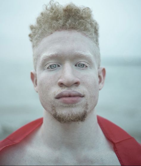 Albino Black People, Black King And Queen, Angel Cat, Black King, Face Photography, African Design, Dream Guy, Male Face, Black Is Beautiful