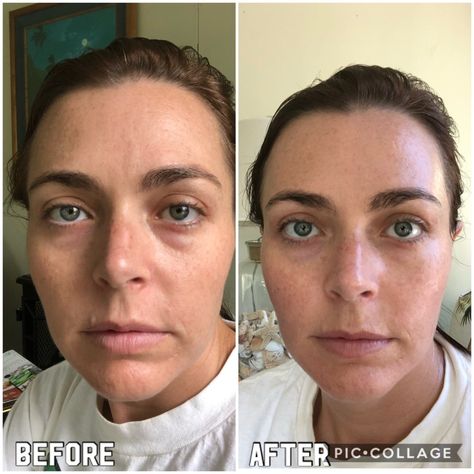 The 5 Minute Facelift: At Home Face Massage – Sarah In Style Facelift Massage, Face Lift Mask, Facelift Before And After, Natural Face Lift, Face Tightening, Instant Face Lift, Diy Spa, Workout Chart, Homemade Face Masks