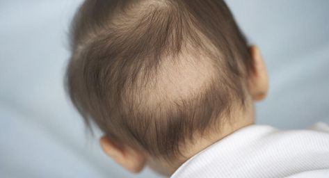 Baby Losing Hair, Hair Growth Stages, Baby Hair Growth, Baby Boy Hairstyles, Hair Style Korea, Lost Hair, Hair Starting, Braids For Black Hair, Boy Hairstyles