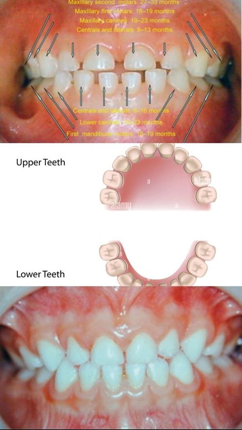 Primary or deciduous dentition.👶 Writing Tips, Writing