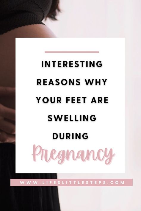 pregnant Swollen Feet Pregnancy, Feet Swelling, Pregnancy Swelling, Swollen Legs, Foot Pain Relief, Foot Pain, A Doctor, What You Can Do, Pain Relief