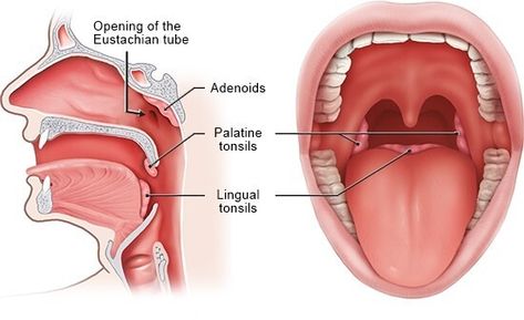 In brief: How do the tonsils work? - InformedHealth.org - NCBI Bookshelf Enlarged Tonsils, Tonsils And Adenoids, Outer Ear, Dog Cuts, Surgery Recovery, White Blood Cells, Medical Terms, Family Doctors, After Surgery