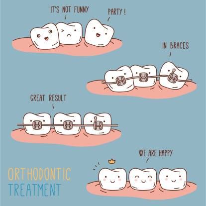 Do you have Crooked Teeth? Crowded Teeth or Gaps in the Teeth? Have one of our award winning Orthodontics examine them. www.rodeodental.com #smile #dental #loveyoursmile Orthodontic Humor, Braces Humor, Teeth With Braces, Teeth Humor, Dental Quotes, Dental Jokes, Emergency Dentist, Karakter Disney, Dental Humor