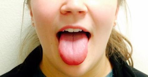 The food resource for our generation Hiccup Remedies, Burnt Tongue, Food Resources, Tongue Health, Do Re Mi, Cleanse Recipes, Health Planner, Abc 123, Healthy Salad