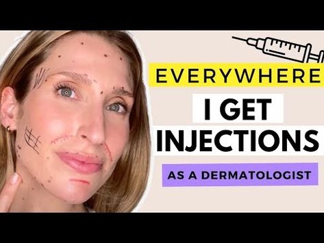 Exactly Where I Get Injections and Why | Best Botox and Filler Placement | Dr. Sam Ellis - YouTube Filler Placement, You Are Awesome, Of Course, Beauty Skin, The Face, Health And Wellness, Health And Beauty, Hair Care, Skin Care