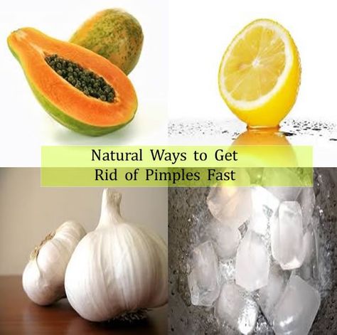 Natural ways to get rid of pimples, mango, lemon, garlic, ice potpourriofwhatever.com Homemade Medicine, Pimples On Forehead, Chest Acne, Get Rid Of Pimples, Rid Of Pimples, Pimples Under The Skin, Skin Tea, Get Rid Of Acne, Rid Of Acne