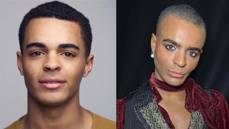 Layton Williams’ plastic surgery might not be very obvious like that of people with botched Botox and fillers but he sure has gotten work done. His before and after pictures will show you that he used to have much softer features and then, he altered his face to give it more definition and a stronger shape. Layton Williams may have had plastic surgery such as a nose job, buccal fat removal, and jaw implants. Layton Williams, Buccal Fat Removal, Botox And Fillers, Nose Job, After Pictures, Fat Removal, Before And After Pictures, Plastic Surgery, Surgery