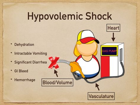 Neurogenic Shock, Hypovolemic Shock, Emt Study, Extracellular Fluid, Adrenergic Receptors, Paramedic Humor, Types Of Shock, Cardiogenic Shock, Paramedic School