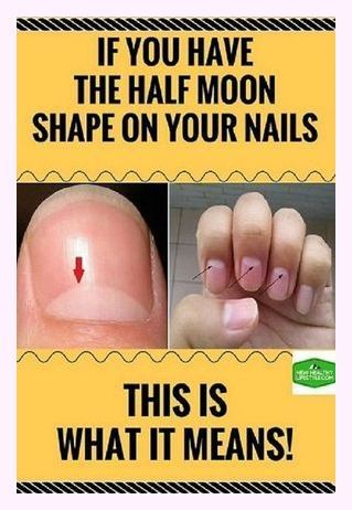 I can’t thank you enough. Enjoyable facts! Half Moon Nails, Fitness Healthy Lifestyle, Moon Nails, Moon Shape, Moon Shapes, Traditional Chinese Medicine, Homeopathy, Natural Medicine, Do You Know What