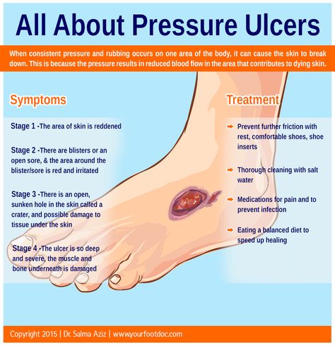 All About Pressure Ulcers Pressure Ulcers Nursing, Wound Care Nursing, Medical Study, Nursing Assessment, Integumentary System, Pressure Ulcer, Medical Procedures, Family Nurse Practitioner, Study Essentials