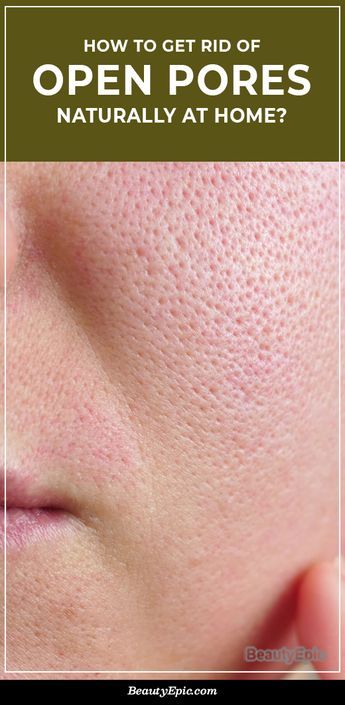 Minimize Pores Naturally, Big Pores, Face Pores, Home Remedies For Skin, Ootd Instagram, Open Pores, Smaller Pores, Natural Face Skin Care, Make Up Videos