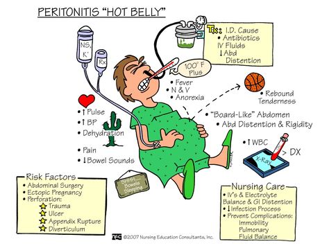 Peritonitis is inflammation of the membranes of the abdominal wall and organs. Peritonitis may be caused by the rupture of infected organs such as the appendix or bowel. Symptoms include strong abdominal (stomach) pain. Peritonitis is life threatening if not treated promptly. The symptoms of peritonitis include: Severe and constant abdominal pain Fever Inability to … Nursing Information, Nursing Board, Med Surg Nursing, Texas Teacher, Nursing Mnemonics, Teacher Certification, Surgical Nursing, Medical Surgical Nursing, Nursing School Survival