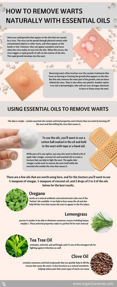 How To Remove Warts Naturally with Essential Oils #OrganicAromas Essential Oils Warts, Warts On Hands, How To Remove Warts, Remove Warts, Lemongrass Tea, Get Rid Of Warts, Deep Cleaning Tips, Cough Remedies, Lose 40 Pounds