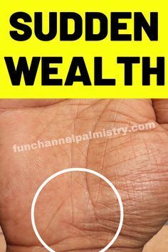 These signs in palmistry indicates sudden wealth and increase in the fortune in your life Palm Reading Lines, Palm Reading Charts, Sudden Wealth, Tarot App, Palmistry Reading, Get Well Messages, Palmistry Hand, Palm Lines, Lucky Sign