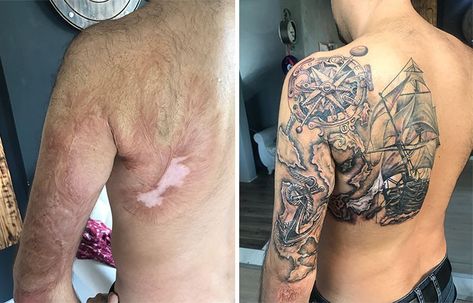 Birthmark Tattoo, Tatuaje Cover Up, Tattoo Over Scar, Scar Cover Up, Tattoos To Cover Scars, Scar Tattoo, Clever Tattoos, Tattoo Cover-up, Cover Up Tattoo