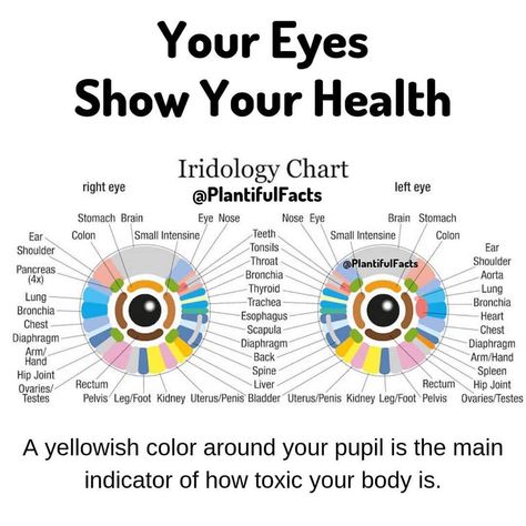 Iridology is based on the scientific study of the iris (the colored part of the eye). Like markings on a map, the iris reveals… Iridology Chart, Eye Color Chart, Health Chart, Parts Of The Eye, Organ System, Body Map, Eye Prescription, Holistic Therapies, Chronic Inflammation