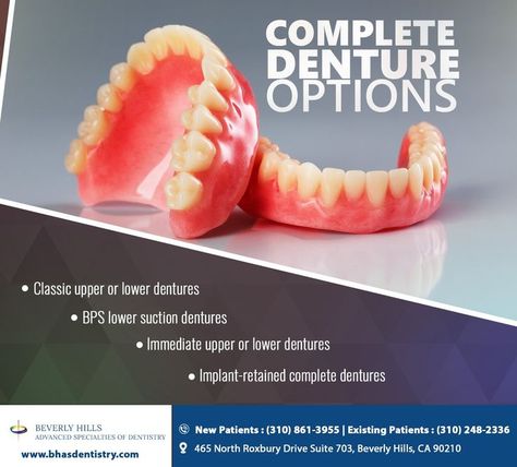 There are multiple options for restoring your smile. Visit https://www.bhasdentistry.com/ to learn more about these and other #denture options and ask us about finding the right option for you. #missingteeth #drfrankvidjak #drfannyyacaman #endodontist #beverlyhills #CA Complete Denture, Denture Implants, Dental Center, Family Dental, Family Dentistry, Dental Procedures, Dentures, Dental Services, Cosmetic Dentistry