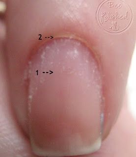 Cuticle Remover Homemade, Diy Cork, Manicure Tutorials, Fungal Nail, Cuticle Care, Manicure Tips, Cuticle Remover, Nail Care Tips, How To Grow Nails