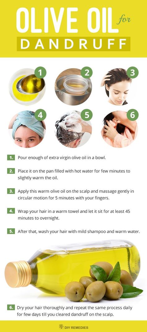 Diy Hair Remedies, Super Hair Growth, Treat Dandruff, Hair Mask For Dandruff, Dandruff Solutions, Home Remedies For Dandruff, Best Olive Oil, Hair Fairy, Rid Of Dandruff