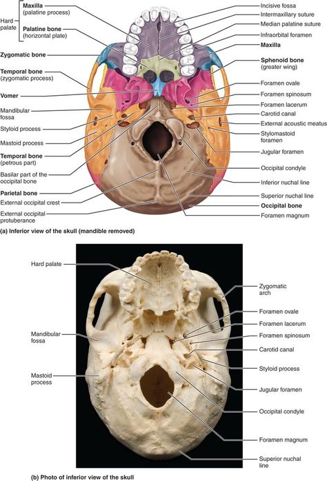 PART 1 THE AXIAL SKELETON - 7.1 The skull consists of 8 cranial bones and 14 facial bones: Human Anatomy and Physiology Cranial Bones, Bones Human, Axial Skeleton, Facial Bones, Skull Anatomy, Anatomy Bones, Dental Hygiene School, Dental Anatomy, Basic Anatomy And Physiology