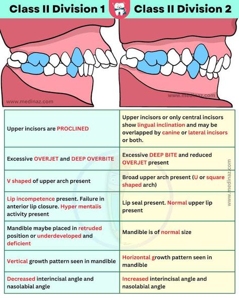 Angle Classification Teeth, Dental School Notes, Dentistry Notes, Dental Notes, Dental Nursing, Hygiene School, Dental Aesthetics, Dental Hygiene School, Dental Fun