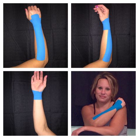 Taping the wrist with kinesio tape https://www.amazon.co.uk/Sports-Kinesiology-Tape-Performance-Waterproof/dp/B06VWMGCCQ/ref=sr_1_1_a_it?ie=UTF8&qid=1495631311&sr=8-1&keywords=kingseye Athletic Training Sports Medicine, Knee Taping, K Tape, Kinesio Tape, Kt Tape, Kinesio Taping, Sports Therapy, Kinesiology Taping, Myofascial Release