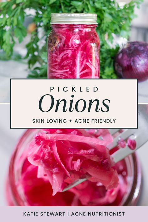 Pickled Onions Diy Pickled Onions, Canned Pickled Onions Canning Recipes, How To Make Pickled Onions, Pickled Purple Onions, Pickling Onions, Pickled Onions Recipe, Smashed Red Potatoes, Pickle Onions Recipe, Pickled Onion