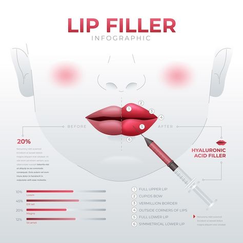 Clinic Aesthetic, Ig Grid, Aesthetic Medical, Gradient Lips, Hyaluronic Acid Fillers, Aesthetic Post, Vector Gradient, Lip Filler, Dermatological Skin Care