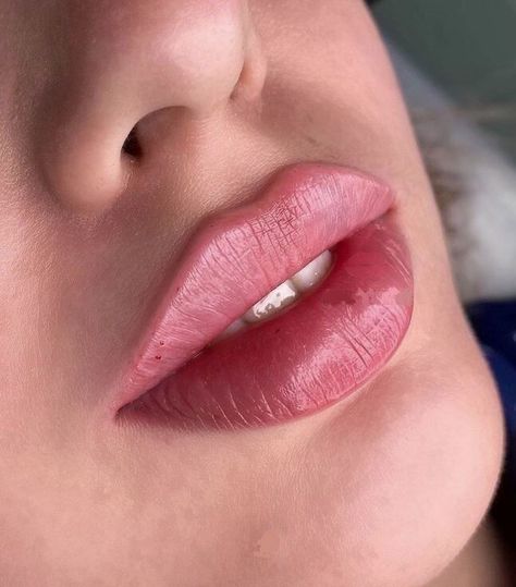 Russian Lips Filler, Desired Lips, Lip Filler Inspiration, Hydra Gloss Lips, Russian Lips, Lips Fillers, Gloss Lips, Lips Inspiration, Botox Lips