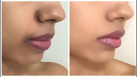 Easy remedy for black patches around mouth and nose for lazy people|#laz... Black Lips Remedy, Dark Skin Around Mouth, Dark Spots Under Eyes, Clean Skin Face, Lip Lightening, Spot Remover, Diy Skin Care Routine, Lip Care Routine, Face Pack