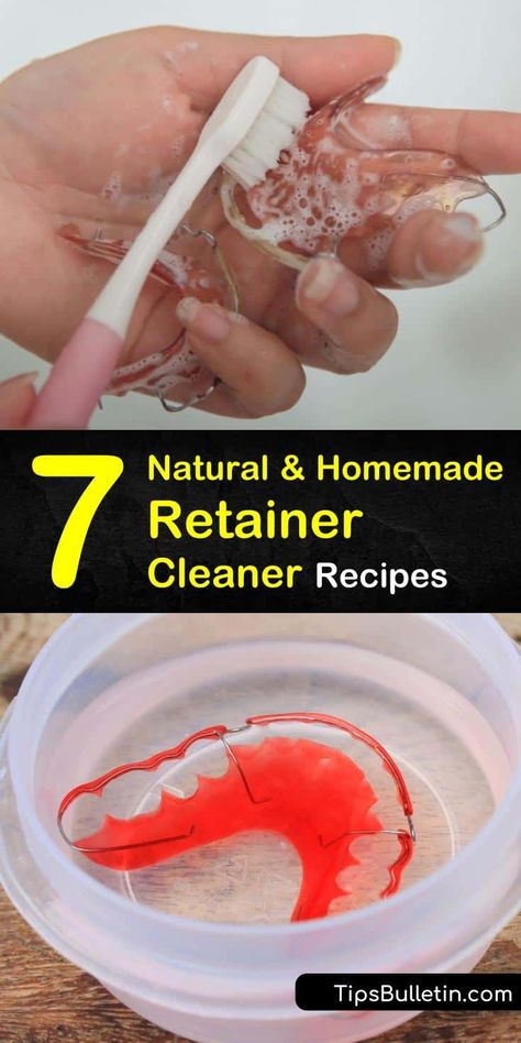 How To Clean Retainers, Retainer Cleaner, Dental Retainer, Denture Cleaner, Homemade Cleaners Recipes, Vinegar Cleaner, Natural Cleaning Solutions, Diy Cleaning Solution, Cleaner Recipes