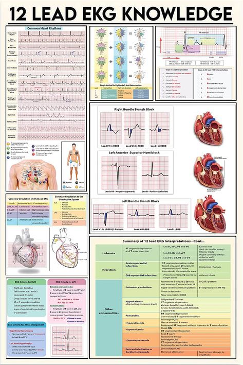 PRICES MAY VARY. Title: 12 LEAD EKG KNOWLEDGE Metal Tin Sign Retro Style Artwork Infographic Analysis For Club Home Office Classroom Living Room Guide Reference Chart Wall Decor 8x12Inches. Product Type: Categories > Office & School Supplies > Store Signs & Displays > Store Signs Nursing School Inspiration, Medical Assistant Student, Nursing School Essential, Medical School Life, Nursing School Motivation, Basic Anatomy And Physiology, Nurse Study Notes, Nursing Student Tips, Medical Student Study