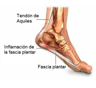 Facitis Plantar, Physiotherapy Clinic, Heel Pain, Foot Pain, Physical Therapy, Fitness Models, Pie, Health